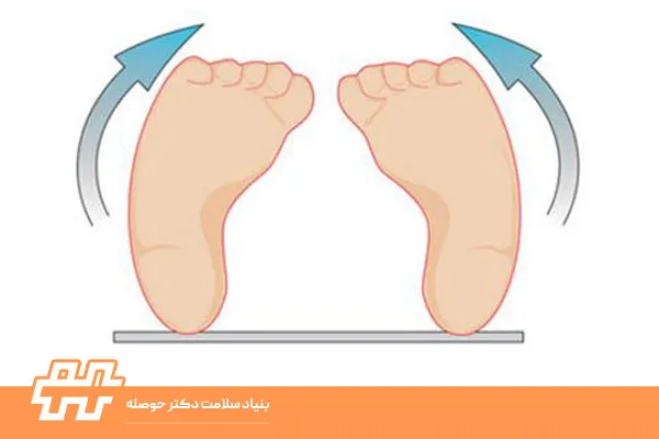 چرخش داخلی پاها در کودکان