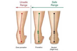 چگونه متوجه شویم پاشنه‌مان به داخل یا خارج متمایل است؟ تست‌های ساده در خانه