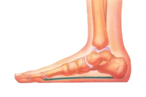 تشخیص صافی کف پا در خانه