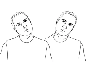 Lateral Head Tilt