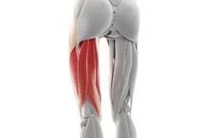 تأثیر کوتاهی همسترینگ بر راه رفتن