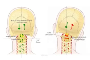 تأثیر کج‌شدن سر بر عملکرد روزمره