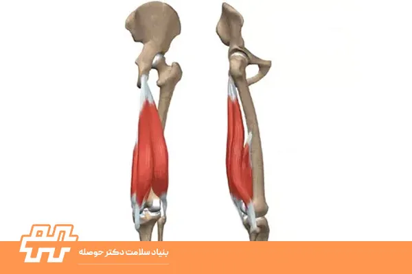 رفع سفتی همسترینگ
