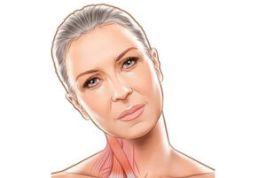 رفع کج‌شدن سر