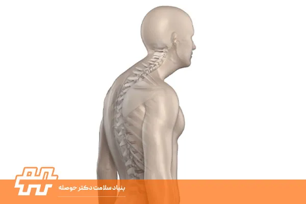 کیفوزیس پشت