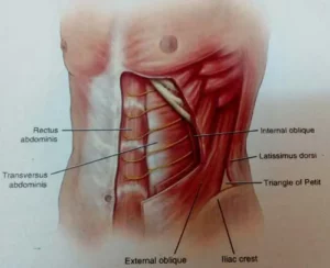سندرم درد دیواره شکمی