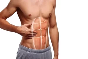 التهاب عضلات شکم