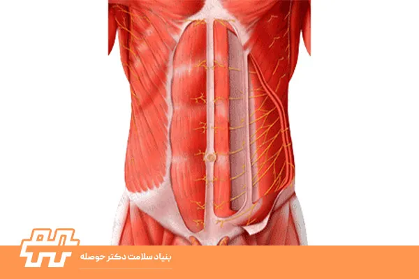 سندرم درد دیواره شکمی